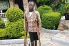 Das Dorf Tanjol Hamlet von Mathew Zachariah Adams wurde am 19. April 2018 von islamistischen Fulani-Milizen angegriffen. Sie schossen auf Mathew und verletzten ihn schwer am rechten Bein. CSI übernahm seine Operationskosten. Foto vor dem Spital in Jos, Bundesstaat Plateau. (csi)