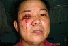 Pastor Nguyen Công Chinh wurde schwer misshandelt (bnl)